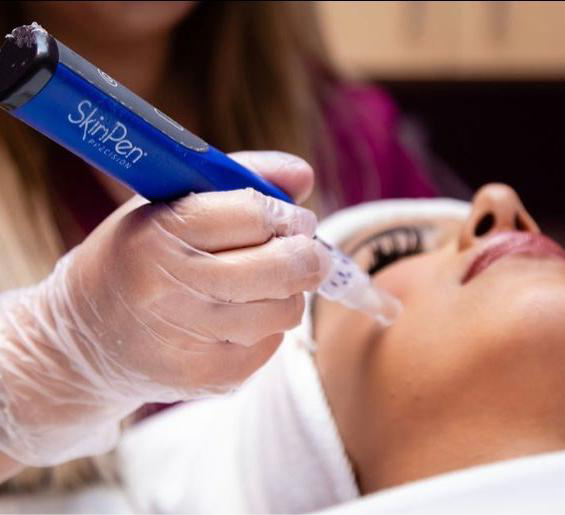SkinPen - Microneedling