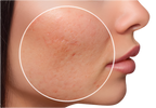Auri Mandel Booster